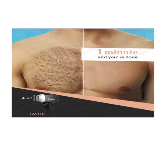 DIODE SOPRANO TRIPPLE WAVELENGTH